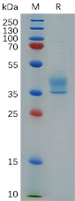 Human CCR8, mFc Tag on SDS-PAGE under reducing condition.